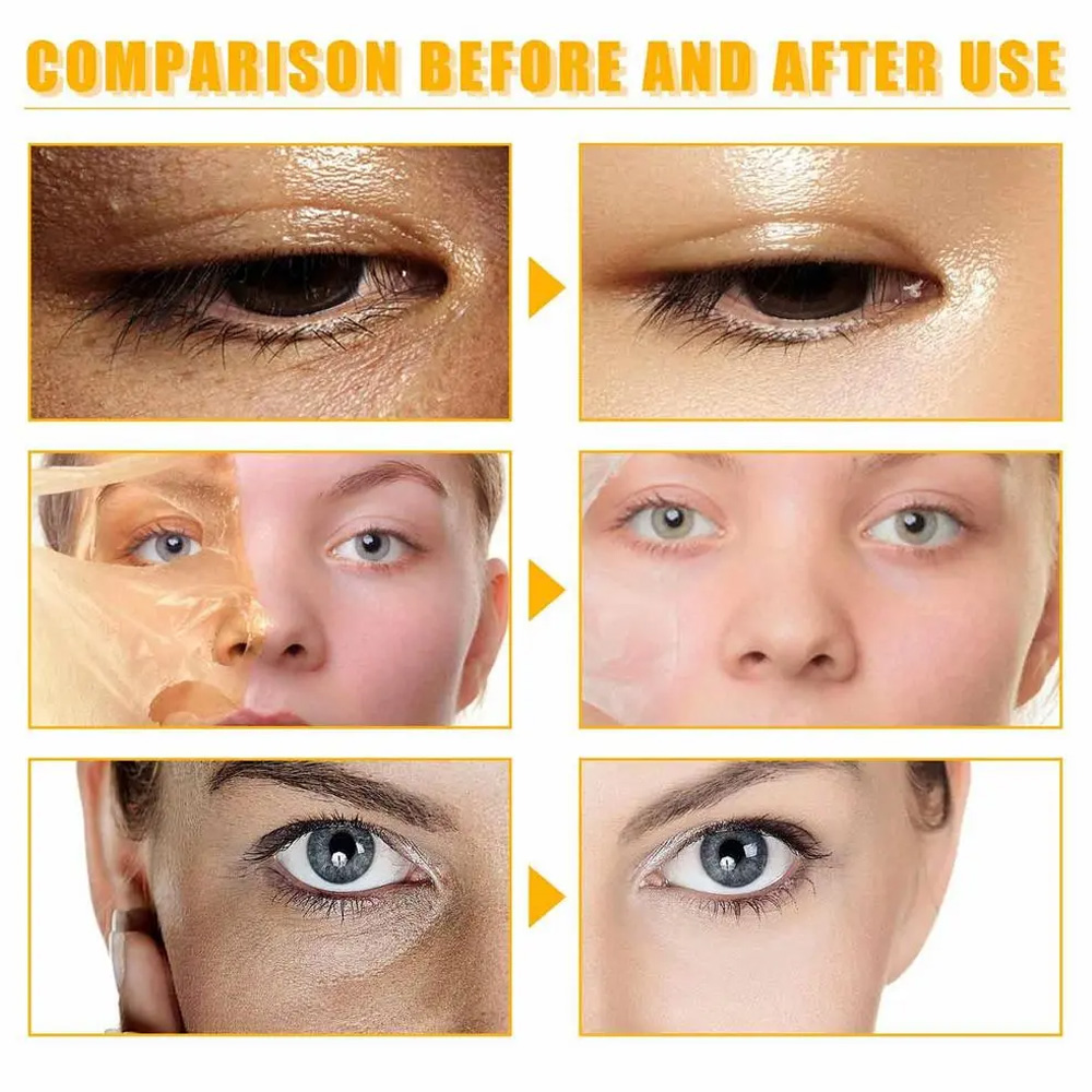 • زيت التقشير الأصفر المعجزة - الصورة 3