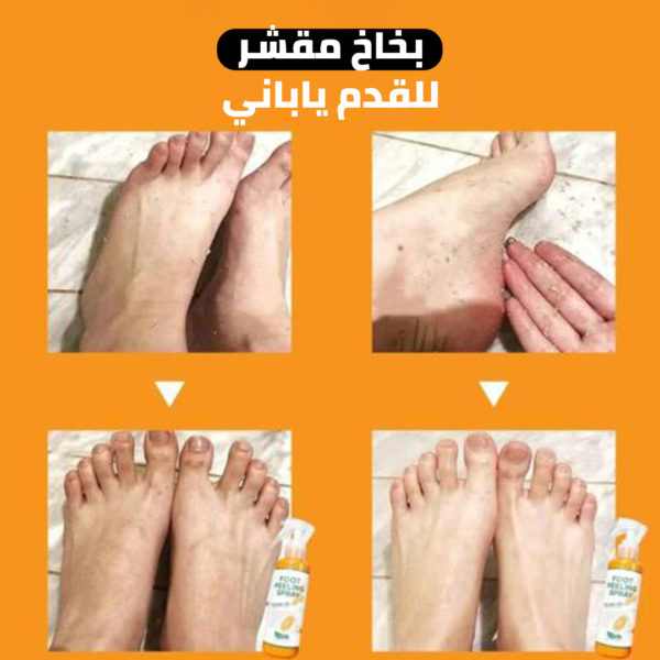 ⁦عرض حبتين بخاخ مقشر للقدم ياباني⁩ - الصورة ⁦2⁩