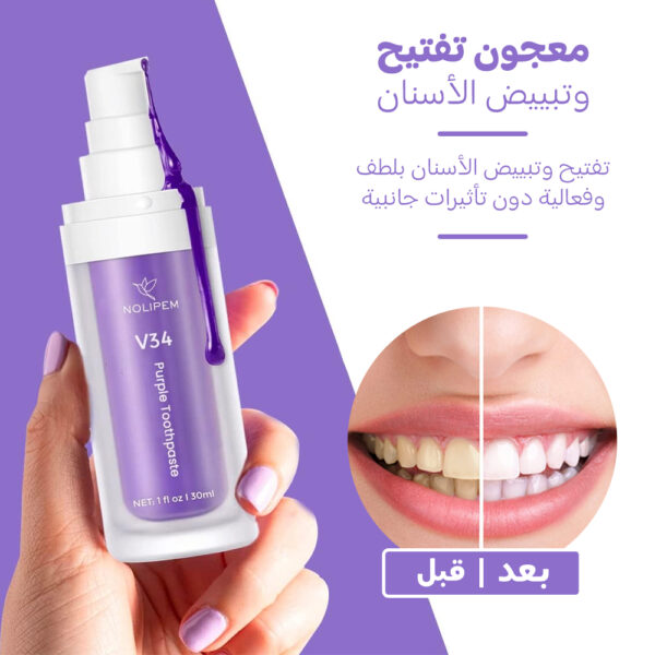 ⁦• عرض 3حبات جيل تبييض وتنظيف الاسنان السحري⁩ - الصورة ⁦6⁩