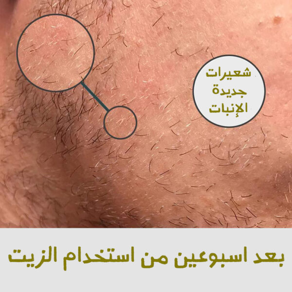 ⁦• زيت تحفيز بصيلات اللحية⁩ - الصورة ⁦4⁩
