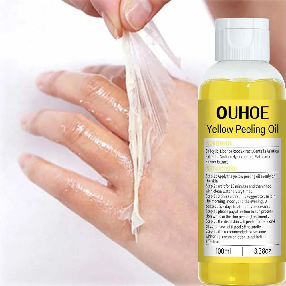 • زيت التقشير الأصفر المعجزة - الصورة 4